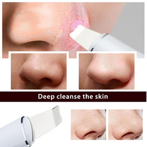 Ultrasonic Skin Scrubber